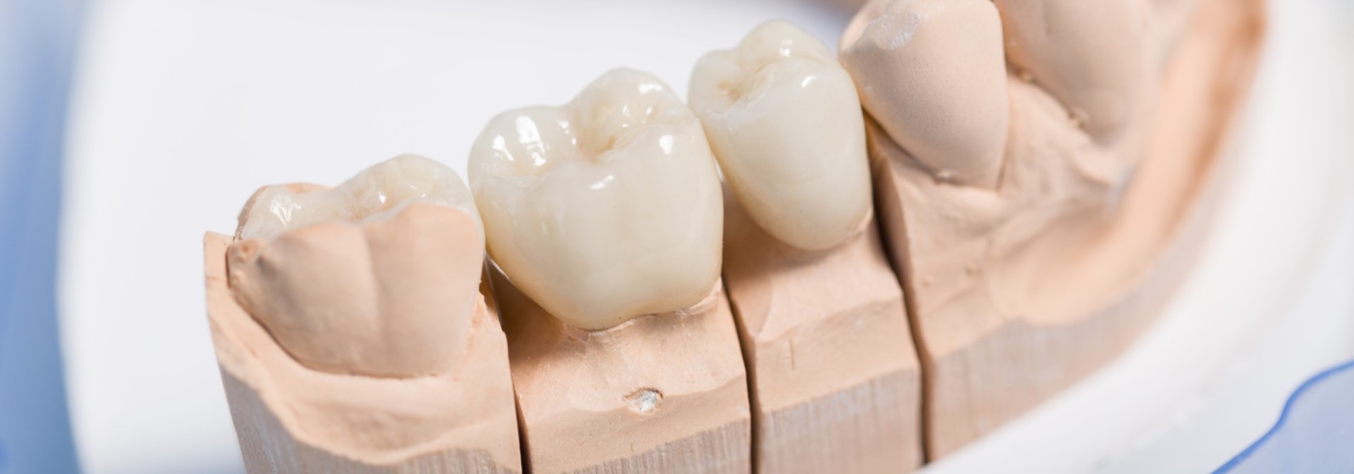 ���₢���킹 SP�g�b�v