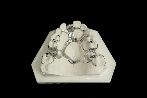 ������ �t���[�����[�N �摜