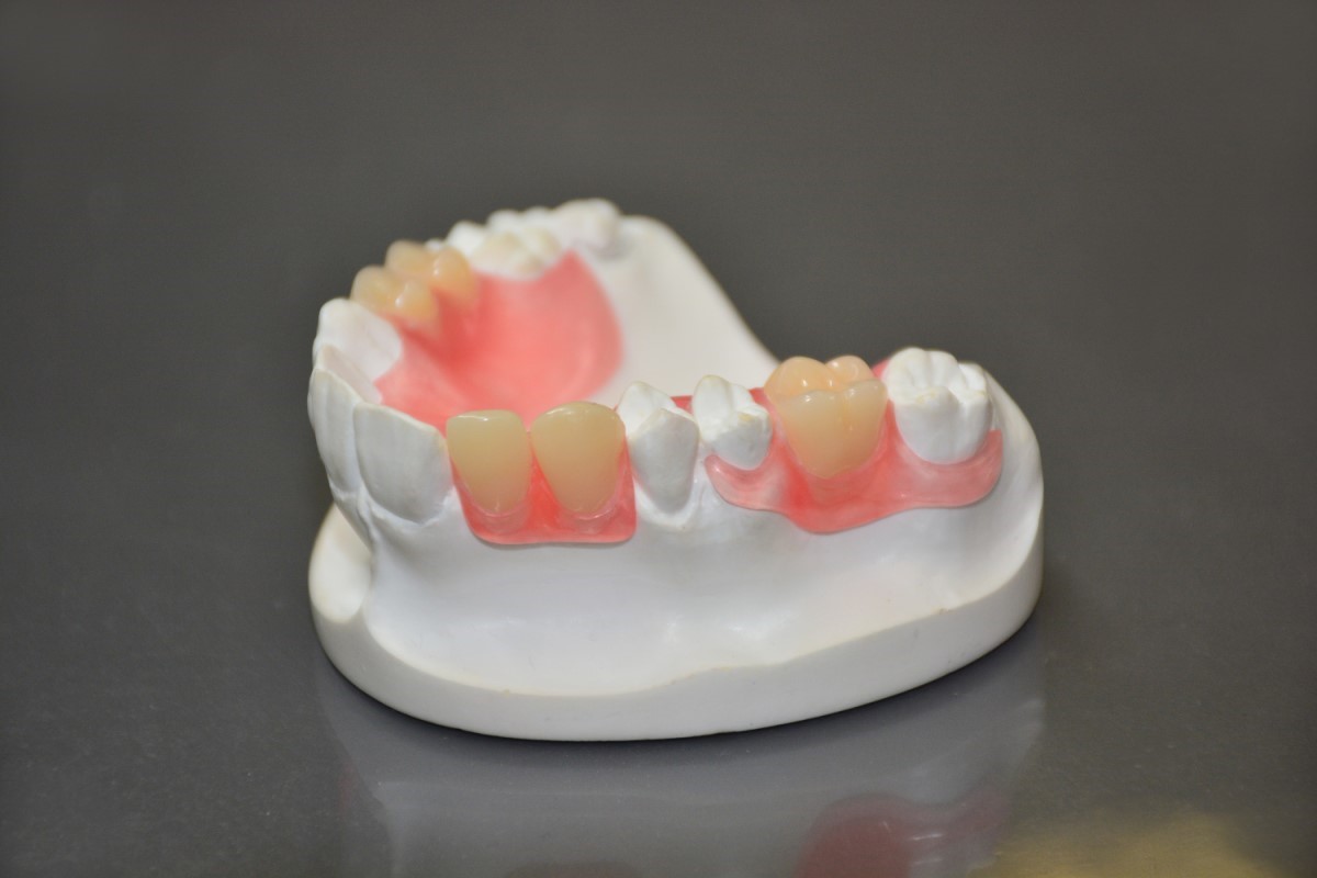 �m���N���X�v�f���`���[